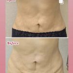 کلینیک زیبایی و طب سوزنی دکتر مهرانه سروش در لاهیجان