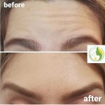 کلینیک زیبایی و طب سوزنی دکتر مهرانه سروش در لاهیجان