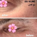 کلینیک زیبایی و طب سوزنی دکتر مهرانه سروش در لاهیجان