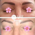 کلینیک زیبایی و طب سوزنی دکتر مهرانه سروش در لاهیجان