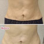 کلینیک زیبایی و طب سوزنی دکتر مهرانه سروش در لاهیجان