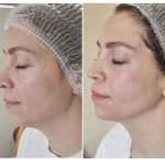 کلینیک زیبایی و طب سوزنی دکتر مهرانه سروش در لاهیجان