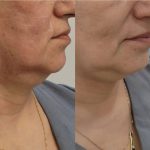 کلینیک زیبایی و طب سوزنی دکتر مهرانه سروش در لاهیجان