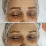 کلینیک زیبایی و طب سوزنی دکتر مهرانه سروش در لاهیجان