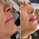 کلینیک زیبایی و طب سوزنی دکتر مهرانه سروش در لاهیجان