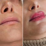 کلینیک زیبایی و طب سوزنی دکتر مهرانه سروش در لاهیجان