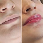 کلینیک زیبایی و طب سوزنی دکتر مهرانه سروش در لاهیجان