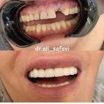 دکتر علی صفوی عباسی در زعفرانیه