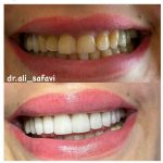 دکتر علی صفوی عباسی در زعفرانیه