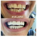 دکتر علی صفوی عباسی در زعفرانیه