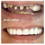 دکتر علی صفوی عباسی در زعفرانیه