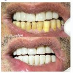 دکتر علی صفوی عباسی در زعفرانیه