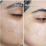 دکتر زینت یکه در لار