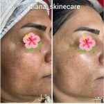 دکتر زینت یکه در لار