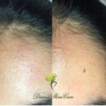 دکتر زینت یکه در لار