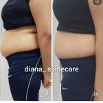 دکتر زینت یکه در لار