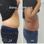 دکتر زینت یکه در لار