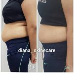 دکتر زینت یکه در لار