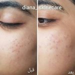 دکتر زینت یکه در لار