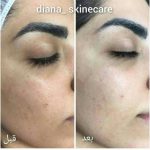 دکتر زینت یکه در لار