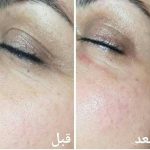 دکتر زینت یکه در لار