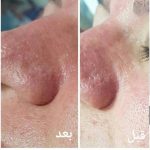 دکتر زینت یکه در لار