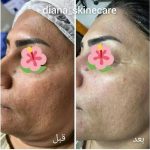 دکتر زینت یکه در لار