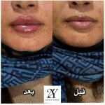 دکتر زینت یکه در لار