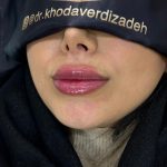 دکتر حسین خداوردی زاده در سراب