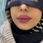 دکتر حسین خداوردی زاده در سراب