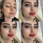 دکتر حسین خداوردی زاده در سراب