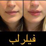 کلینیک پوست و زیبایی کیمیا در لاهیجان