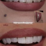 دکتر سعید حاجی پور در تبریز