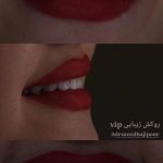 دکتر سعید حاجی پور در تبریز