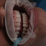 دکتر سعید حاجی پور در تبریز