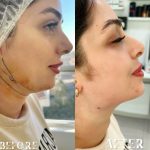 کلینیک پوست و زیبایی یاس سفید در لاهیجان