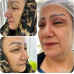 کلینیک پوست و زیبایی یاس سفید در لاهیجان