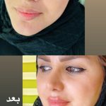 کلینیک پوست و زیبایی یاس سفید در لاهیجان