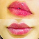 کلینیک پوست و زیبایی یاس سفید در لاهیجان