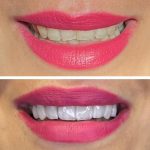 مطب دندانپزشکی دکتر لیلا پورنظری در رودبار