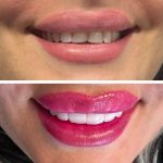 مطب دندانپزشکی دکتر لیلا پورنظری در رودبار