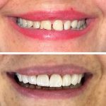 مطب دندانپزشکی دکتر لیلا پورنظری در رودبار