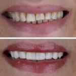 مطب دندانپزشکی دکتر لیلا پورنظری در رودبار