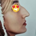 جراح پلاستیک بینی دکتر علی حقیقتیان در شیراز