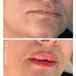 دکتر فاطمه پورمجد در صومعه سرا