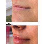 دکتر فاطمه پورمجد در صومعه سرا