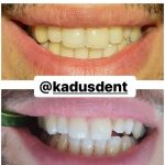 کلینیک دندانپزشکی کادوس در رشت