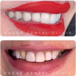 کلینیک دندانپزشکی کادوس در رشت