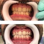 کلینیک دندانپزشکی کادوس در رشت