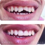 کلینیک دندانپزشکی کادوس در رشت